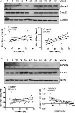 Phospho-SMAD2 (Ser465, Ser467) Antibody in Western Blot (WB)