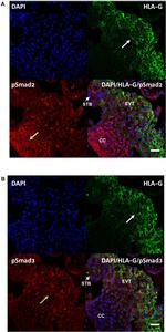 Phospho-SMAD2 (Ser465, Ser467) Antibody in Immunohistochemistry (IHC)