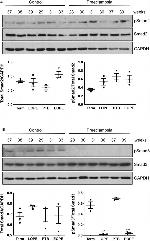 Phospho-SMAD2 (Ser465, Ser467) Antibody in Western Blot (WB)