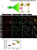 beta Tubulin Antibody in Immunocytochemistry (ICC/IF)