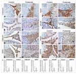 SERPINA12 Antibody in Immunohistochemistry (IHC)