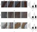 Alpha-Smooth Muscle Actin Antibody in Immunohistochemistry (IHC)