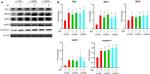 RIG-I Antibody in Western Blot (WB)