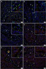 SOX2 Antibody in Immunohistochemistry (IHC)