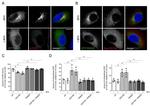 beta COP Antibody in Immunocytochemistry (ICC/IF)