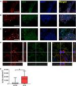 ST2 Antibody in Immunohistochemistry (IHC)