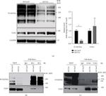 O-linked N-acetylglucosamine (O-GlcNAc) Antibody in Western Blot, Immunoprecipitation (WB, IP)