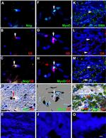 MYOD Antibody in Immunocytochemistry (ICC/IF)