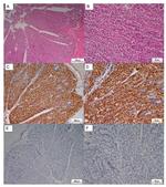 CD20 Antibody in Immunohistochemistry (IHC)