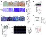 Collagen II Antibody in Immunohistochemistry (IHC)