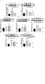 SLC27A1 Antibody in Western Blot (WB)