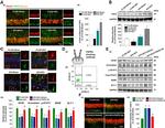 Aromatase Antibody in Western Blot (WB)