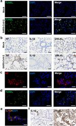 Phospho-MLKL (Ser345) Antibody in Immunohistochemistry (IHC)