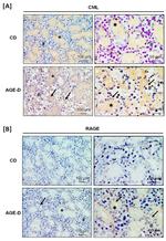 RAGE Antibody in Immunohistochemistry (IHC)