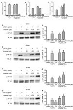 NFkB p65 Antibody in Western Blot (WB)