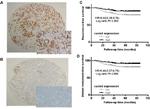 PRKCDBP Antibody in Immunohistochemistry (IHC)