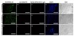 Borrelia burgdorferi Antibody in Immunohistochemistry (IHC)