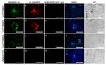 Borrelia burgdorferi Antibody in Immunohistochemistry (IHC)