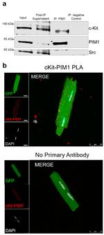 PIM1 Antibody in Immunocytochemistry, Proximity Ligation Assay (PLA) (ICC/IF, PLA)