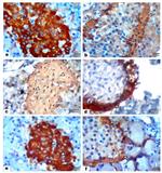 Glucagon Antibody in Immunohistochemistry (IHC)