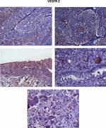 VEGF Receptor 2 Antibody in Immunohistochemistry (IHC)