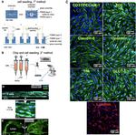 GLUT1 Antibody in Immunocytochemistry (ICC/IF)