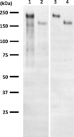 Ataxin 2 Antibody in Western Blot (WB)