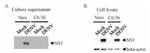 Dengue Virus Type 2 NS1 Antibody in Western Blot (WB)