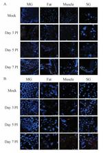 Dengue Virus Type 2 NS1 Antibody in Immunohistochemistry (IHC)