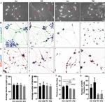 MAP2 Antibody in Immunocytochemistry (ICC/IF)