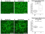 ATP5A1 Antibody in Immunohistochemistry (IHC)