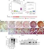 ST3GAL1 Antibody in Immunohistochemistry (IHC)