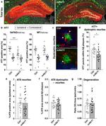 Tau Antibody in Immunohistochemistry (IHC)