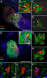 MBP Antibody in Immunocytochemistry (ICC/IF)