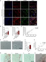 CD68 Antibody in Immunohistochemistry (IHC)