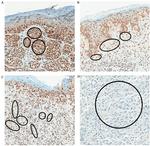 FBXW7 Antibody in Immunohistochemistry (IHC)