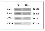 PAK1 Antibody in Western Blot (WB)