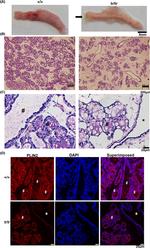 ADFP Antibody in Immunohistochemistry (IHC)