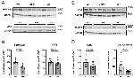 Calsequestrin Antibody in Western Blot (WB)