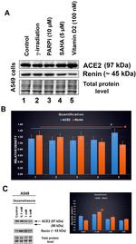 Renin Antibody in Western Blot (WB)