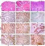 Osteopontin Antibody in Immunohistochemistry (IHC)