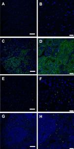 Alexa Fluor 488 Antibody in Immunohistochemistry (IHC)