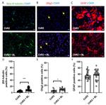 GFAP Antibody in Immunocytochemistry (ICC/IF)