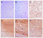 Bcl-B Antibody in Immunohistochemistry (IHC)