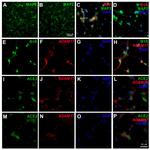 MAP2 Antibody in Immunocytochemistry (ICC/IF)