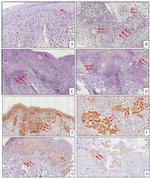 MIF Antibody in Immunohistochemistry (IHC)