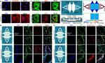 P-Selectin Antibody in Immunocytochemistry (ICC/IF)