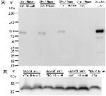 CEA Antibody in Western Blot (WB)