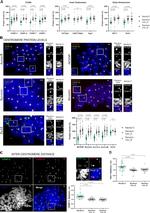 HEC1 Antibody in Immunocytochemistry (ICC/IF)