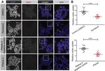 6x-His Tag Antibody in Immunocytochemistry (ICC/IF)